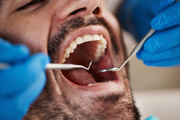 Sedation Dentistry in Calcutta, OH