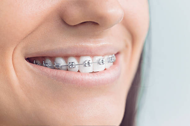 Best Traditional Braces  in Calcutta, OH